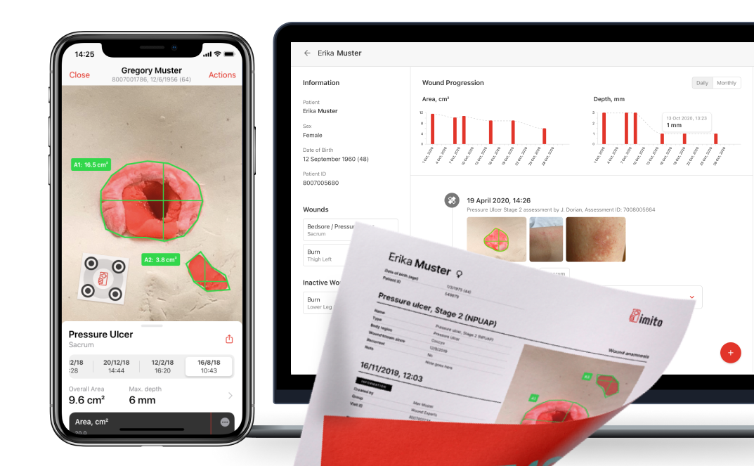 Wound documentation app - alternative to wound measurement with a wound ruler