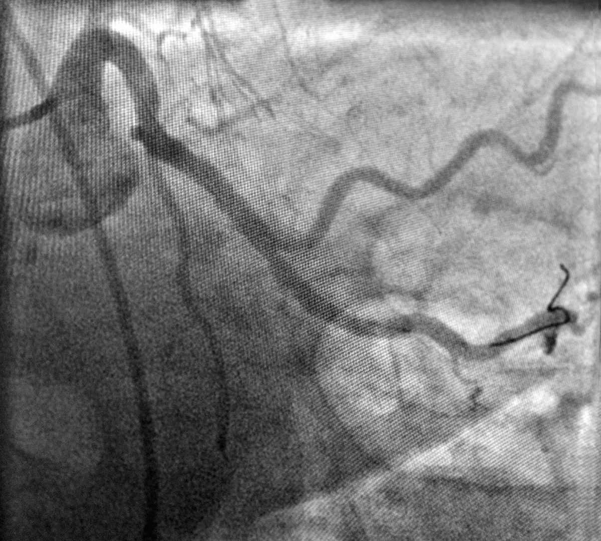 Rezultatul în urma investigației | Centrele ARES