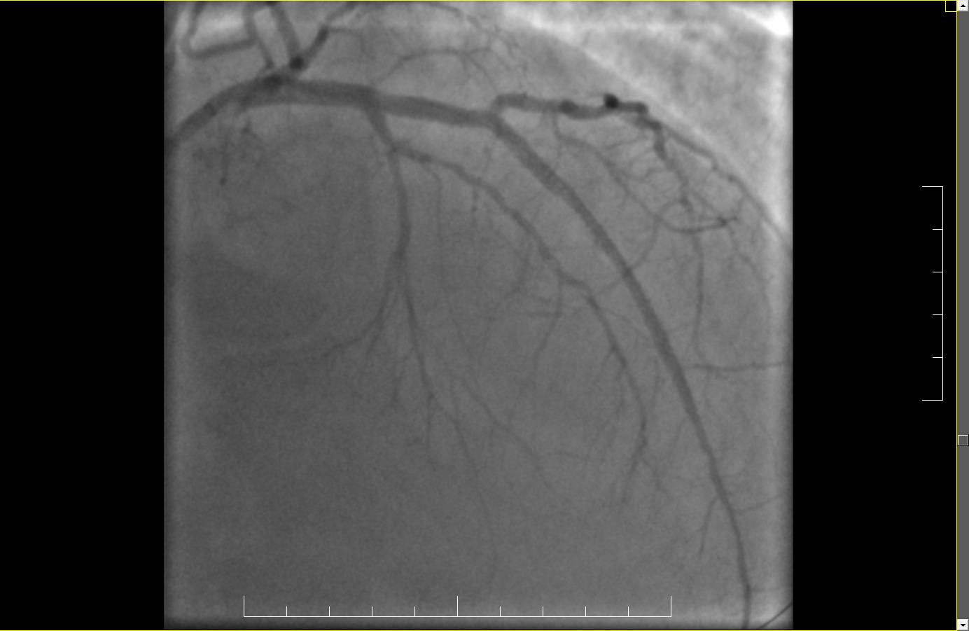 Rezultatul final | Spitalele ARES