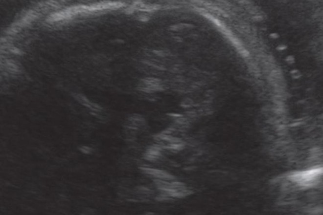 Week-by-week pregnancy scan photos - Netmums