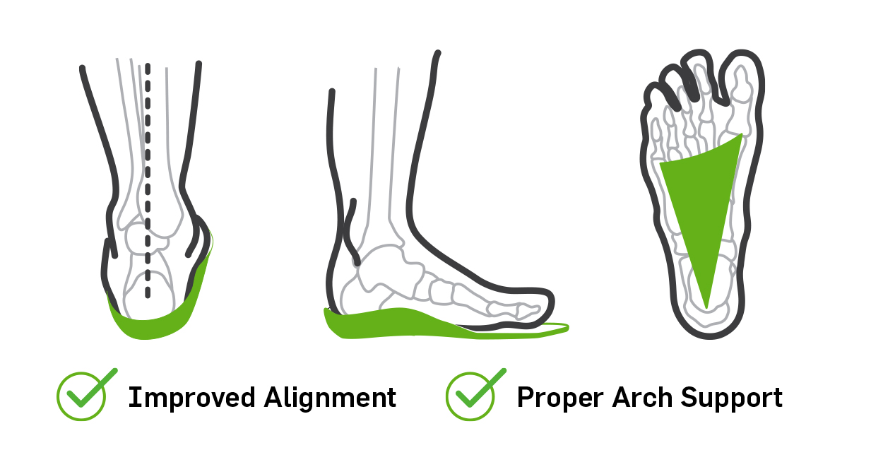 Visual of the how the Oboz Footwear insole helps align your gait.
